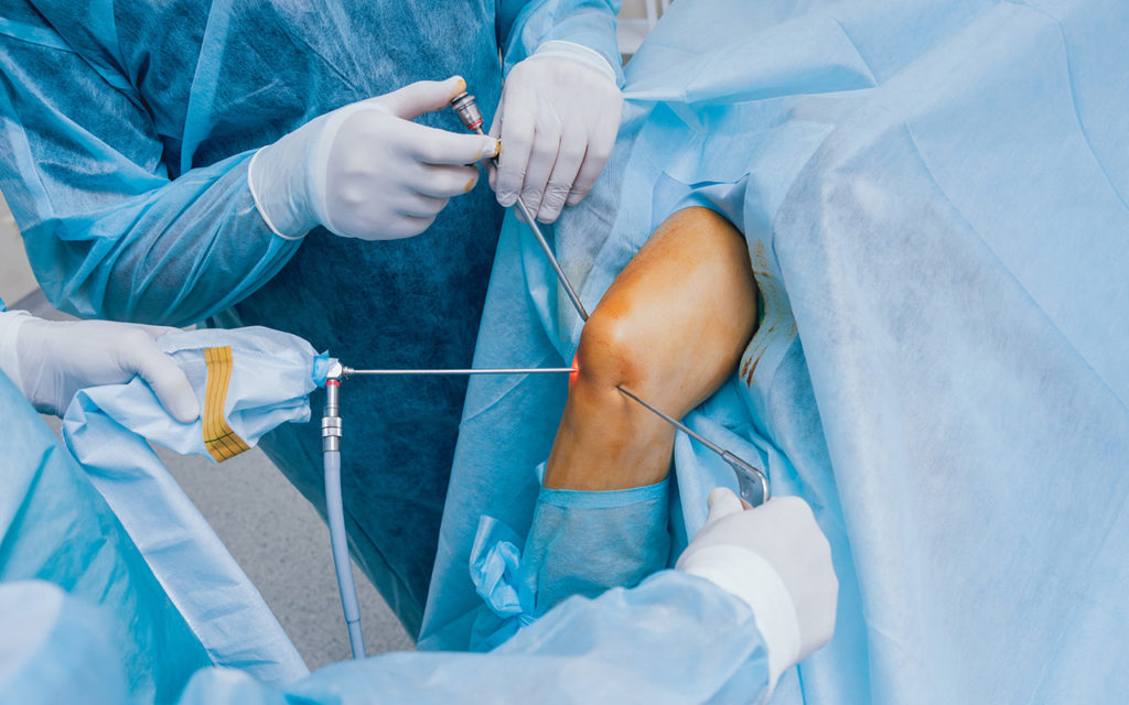 KNEE ARTHROSCOPY